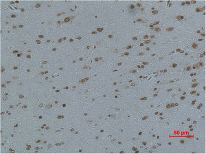 CACNG4 antibody