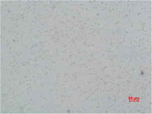 CACNG5 Antibody
