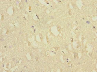 CACNG7 Antibody