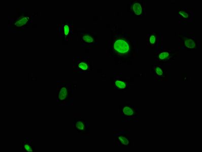 CACYBP Antibody