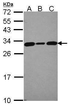 CacyBP antibody