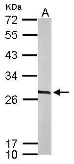 CacyBP antibody