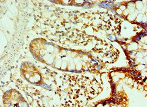 Cadherin-17 antibody