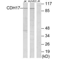 Cadherin-17 antibody