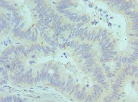 CADM1 Antibody
