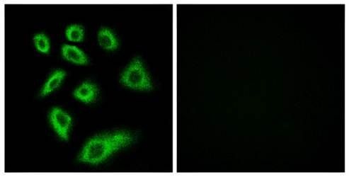 Cytochrome P450 2W1 Antibody