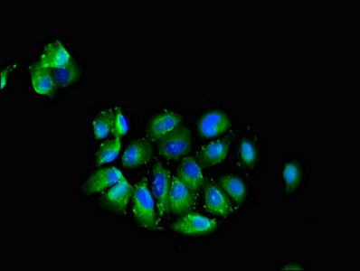 CADM3 antibody