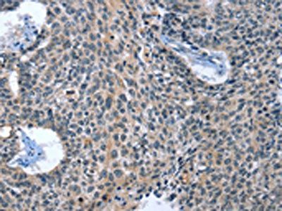 CAGE1 Antibody