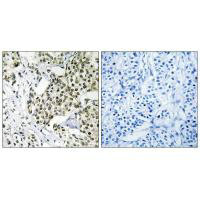 CAGE1 Antibody