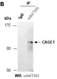 CAGE1 (C) Antibody, Rabbit Polyclonal