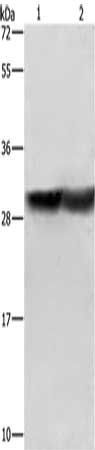 CALB1 antibody