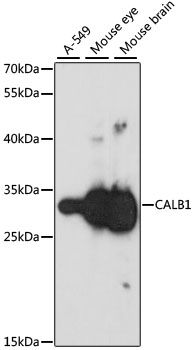 CALB1 antibody