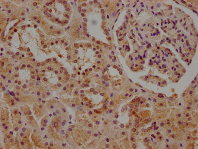 CALB1 antibody