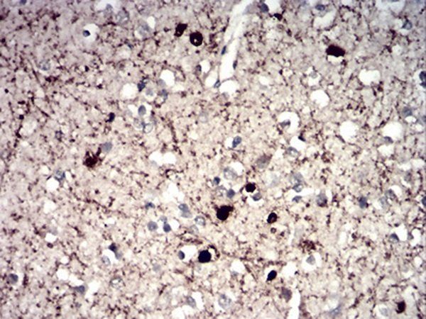 CALB2 Antibody