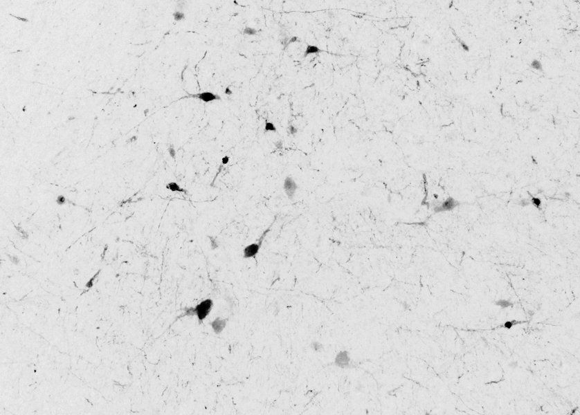 Goat anti-calbindin D28 Antibody
