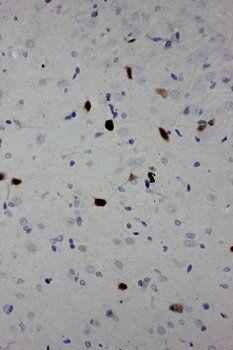 Calbindin-D Calb1 Antibody (Monoclonal, CB-955)