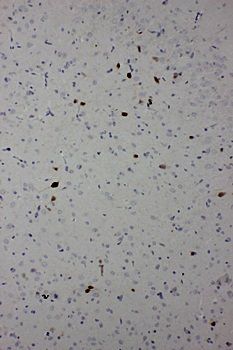 Calbindin-D Calb1 Antibody (Monoclonal, CB-955)