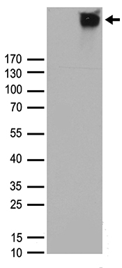 Calcineurin A Antibody