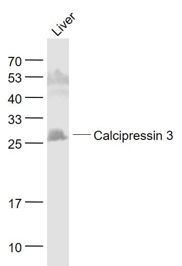 Calcipressin 3 antibody