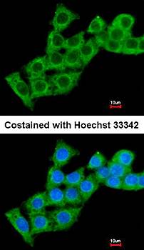 calcium binding protein P22 antibody