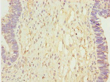 CALCOCO2 Antibody