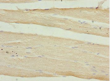 CALCOCO2 Antibody