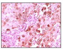 S100A6 Antibody