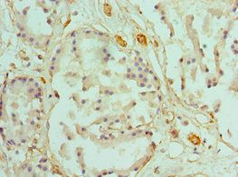 CALD1 Antibody