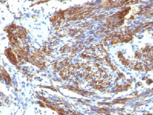 CALD1 Antibody