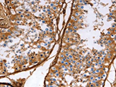 CALD1 Antibody