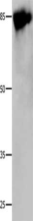 CALD1 Antibody