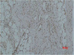 CALHM1 antibody