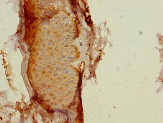 CALML3 Antibody