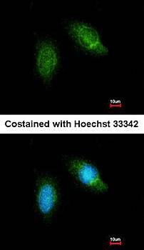 Calpain 5 antibody