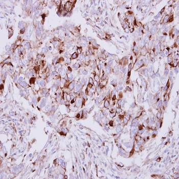 Calpain 5 antibody