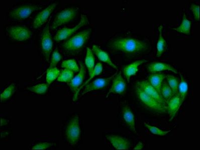 CAST Antibody