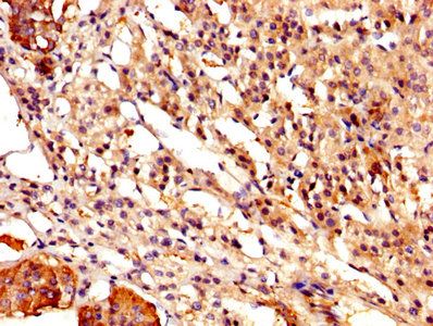 CAST Antibody