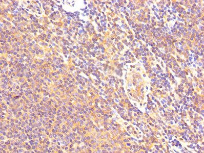 CAST Antibody