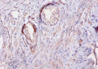 CAST Antibody
