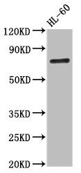 Calpastatin antibody