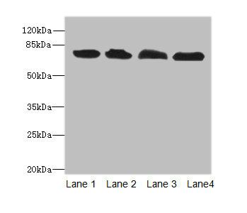 Calpastatin antibody