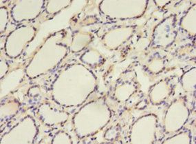 CALR Antibody