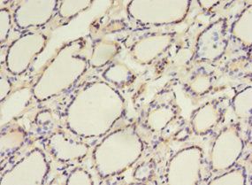 CALR antibody