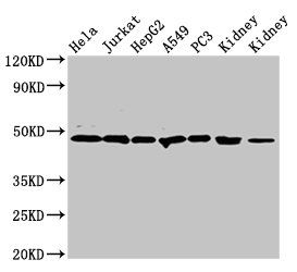 CALR antibody