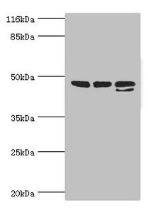 CALR antibody