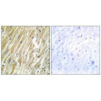CALR Antibody