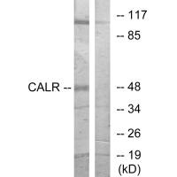 CALR antibody