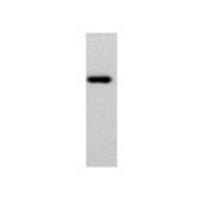 Calreticulin 3 Antibody