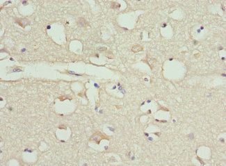 CALR Antibody