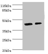 Calreticulin antibody